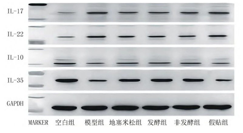 空白组和支气管哮喘各组大鼠肺组织中IL－17、IL－22、IL－10、IL－35蛋白表达电泳图